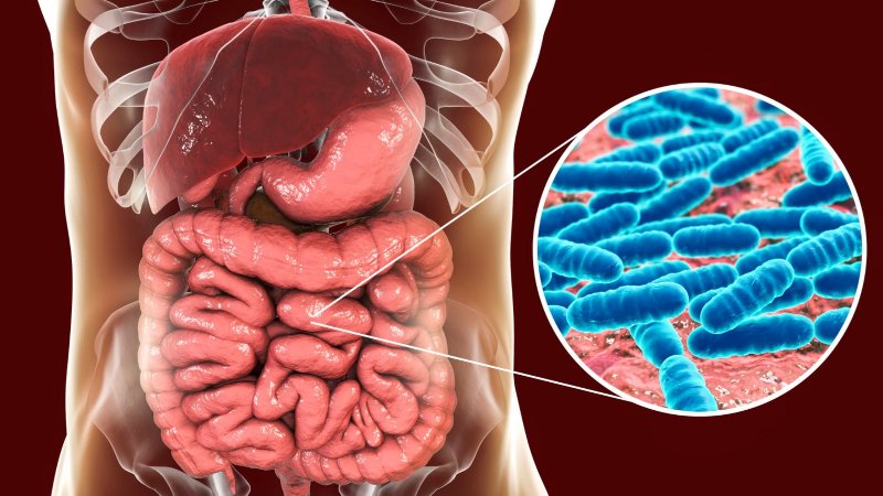 Disbiose intestinal: o delicado equilíbrio da nossa microbiota