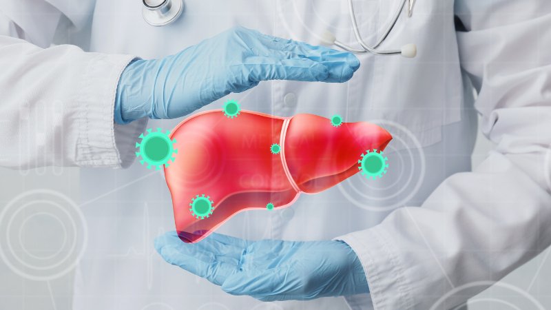 Esteatose hepática: sintomas, causas e prevenção